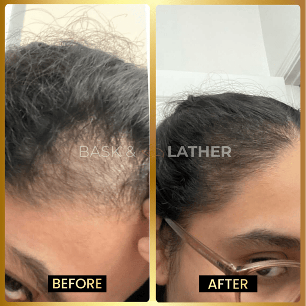 The Ultimate Growth Starter Set