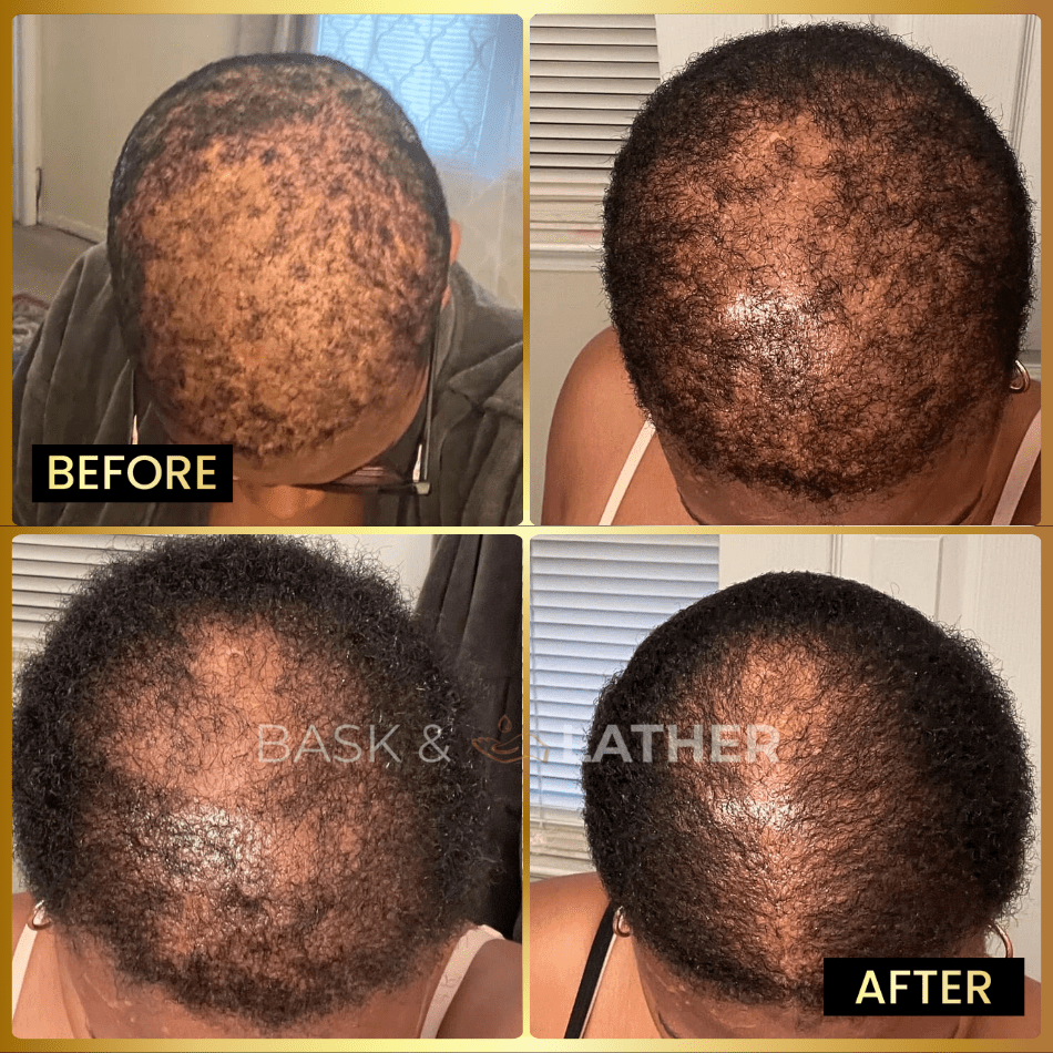 Men's Beard & Hair Growth Bundle