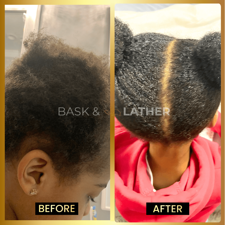 BALM- Stimulating Scalp and Hair Balm