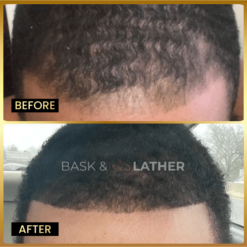 Men's Beard & Hair Growth Bundle