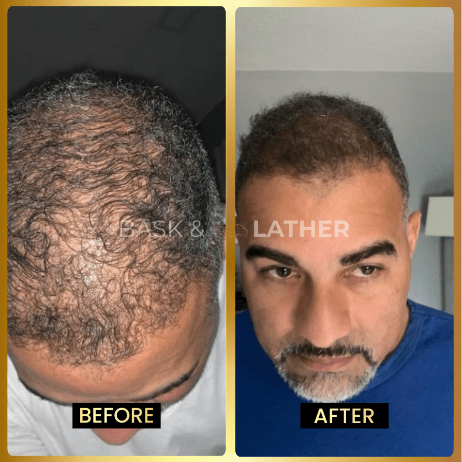 Men's Beard & Hair Growth Bundle