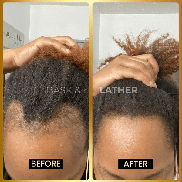 JUMBO Scalp Stimulator