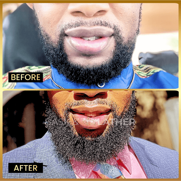 Beard Oil – Beard Softener & Growth Enhancer