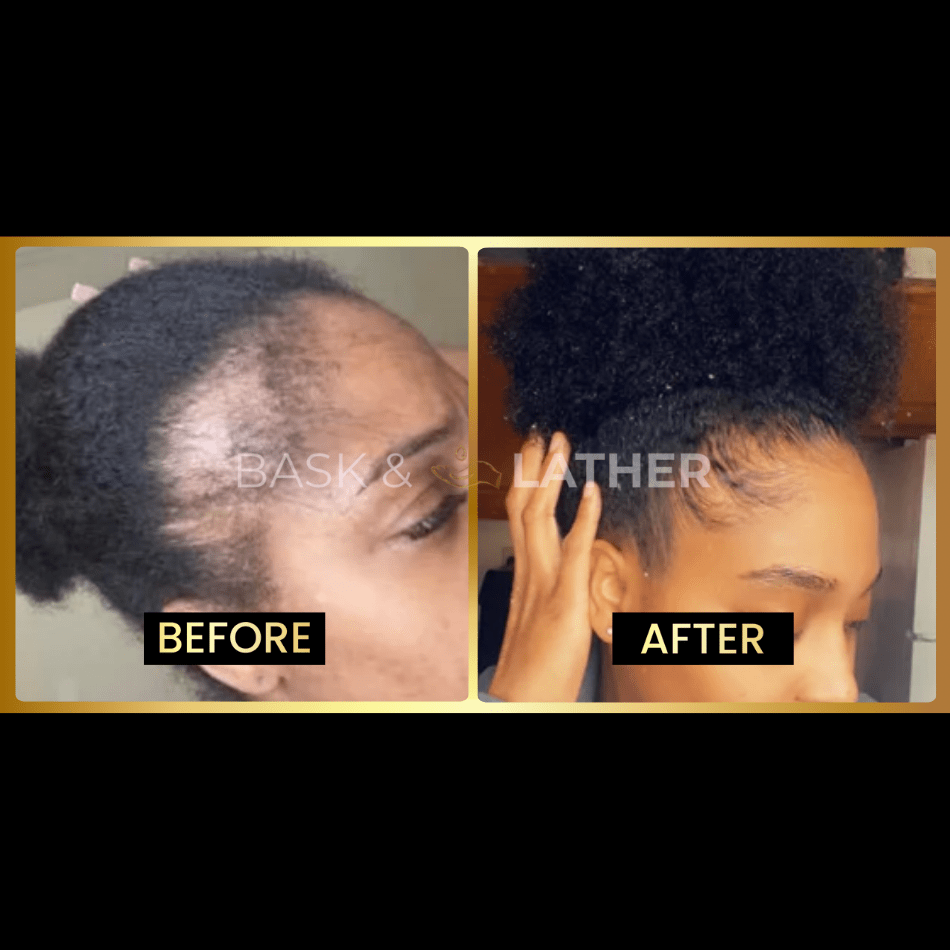 JUMBO Scalp Stimulator