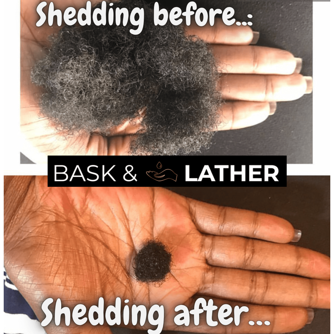 Healthy Hair Starter Kit- Limited Edition