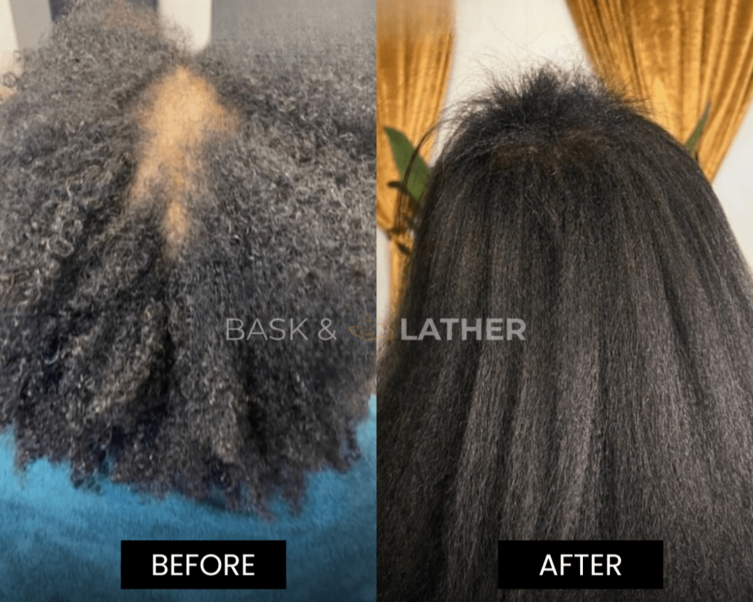 XL Cleanse and Growth Bundle - For Moisture & Hydration