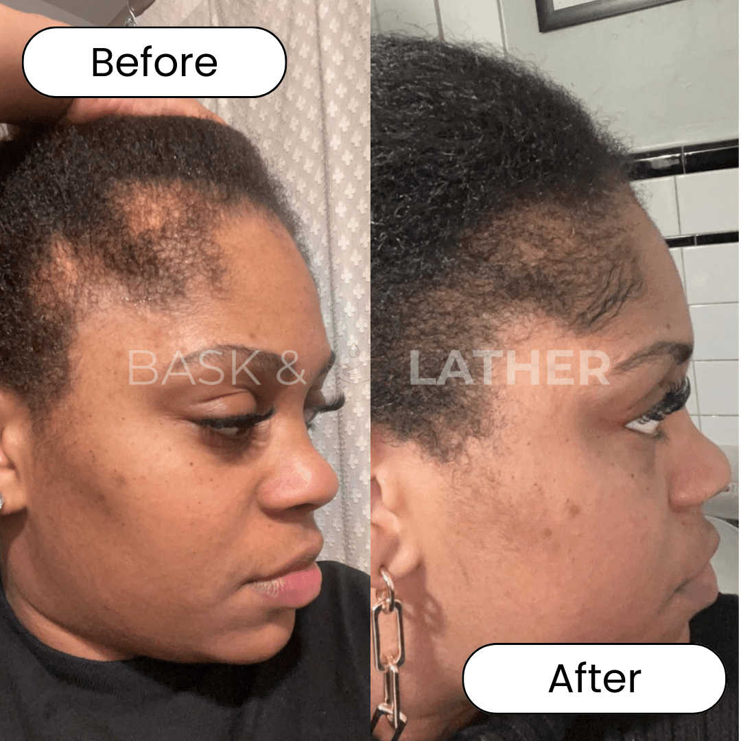 XL Cleanse and Growth Bundle - For Moisture & Hydration